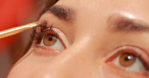 eyelid asymmetry
